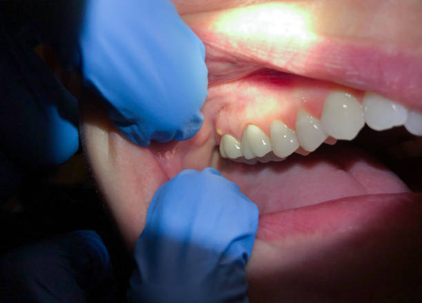 Best Emergency Denture Repair in Ellerslie, GA